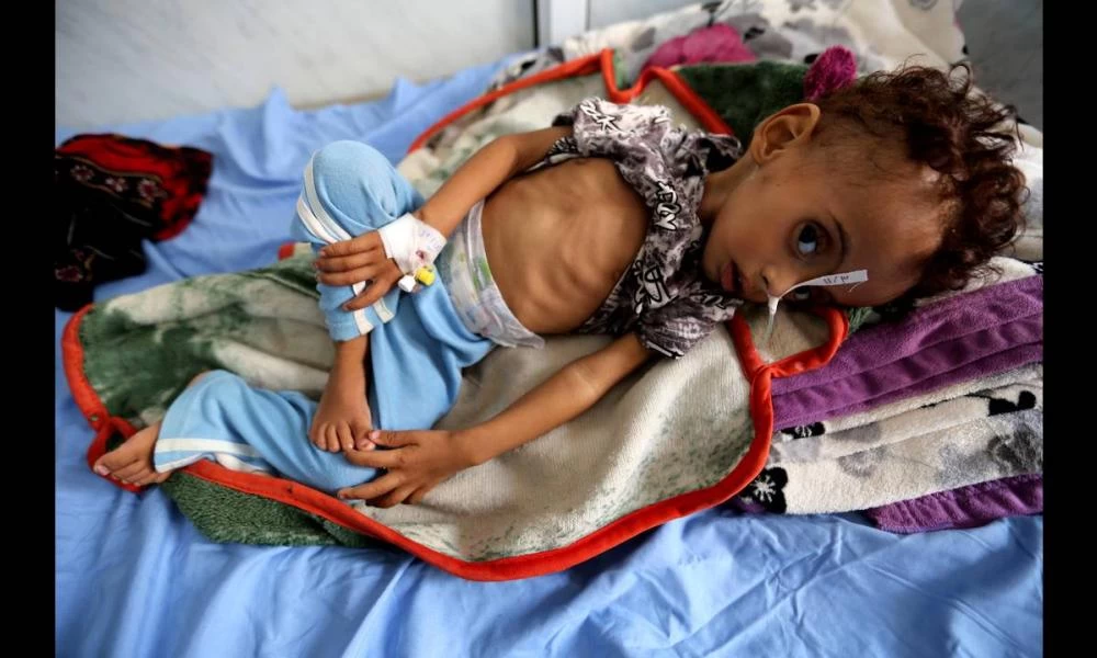 Χιλιάδες παιδιά θα πεθάνουν από πείνα λόγω της πανδημίας